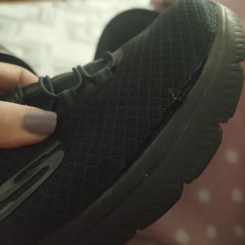 Ayakkabının Kenarında Açılma Ve İade Talebimin Reddi