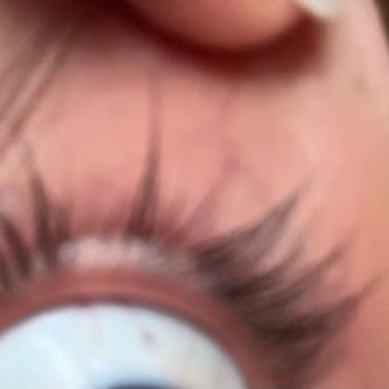 L'Oreal Maskara Kullanımından Sonra Kirpik Dökülmesi Ve Ücret İadesi Talebi