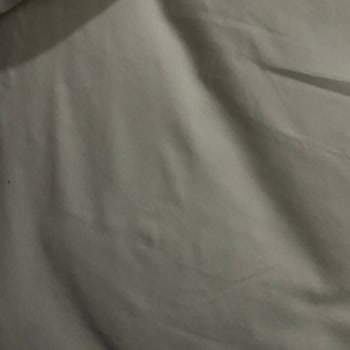 Arya Termal Otel'de Hijyen Sorunu Ve İlgisiz Yaklaşım