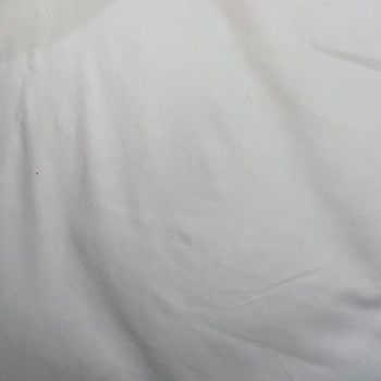 Arya Termal Otel'de Hijyen Sorunu Ve İlgisiz Yaklaşım