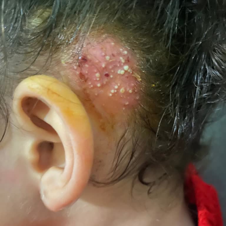 Üç Saat Beklemek Dört Yaşındaki Çocuğumun Deri Tedavisinde Haksızlık