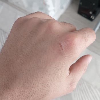 Epttavm Kargo Çamurda Bırakıldı, 3. Kata Tek Başıma Taşıdım Ve Yaralandım