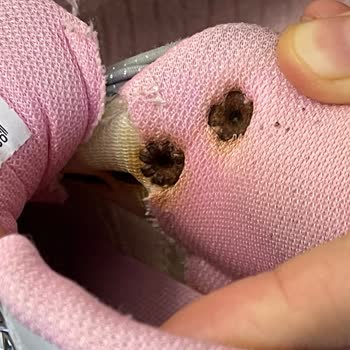 Vicco Çocuk Ayakkabısında Kısa Sürede Paslanma ve Malzeme Bozulması