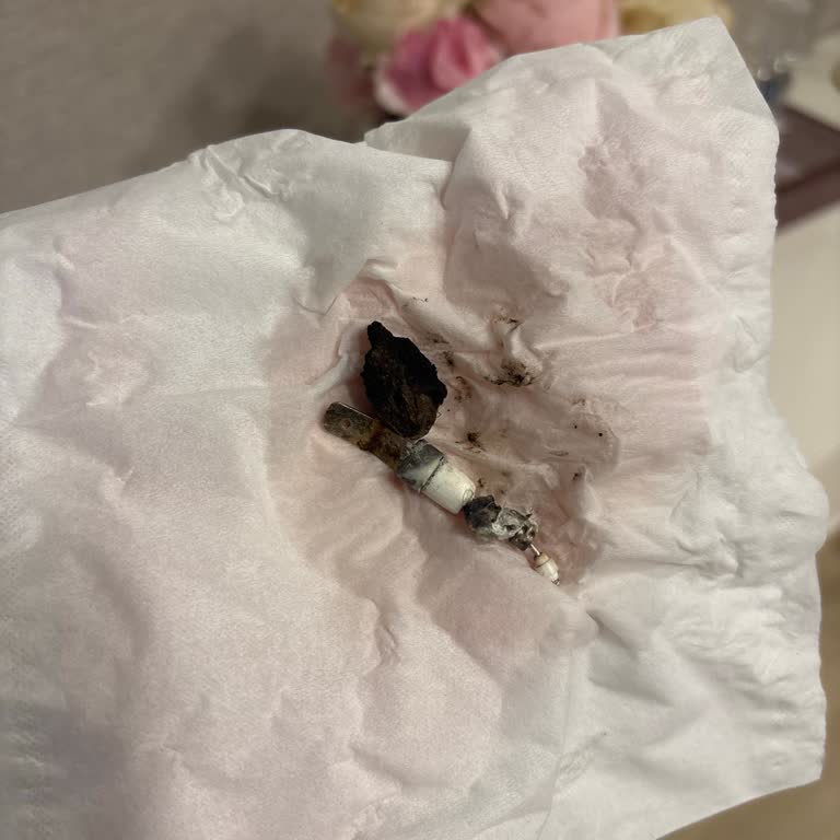 Bosch Çamaşır Makinemde Alev Çıktı, Güvenlik Sorunu Ve Servis Ücretinin İadesi Talebi