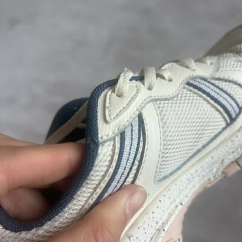 Skechers Ayakkabım 4 Ayda Deforme Oldu, Garanti Reddiyle Mağdur Oldum