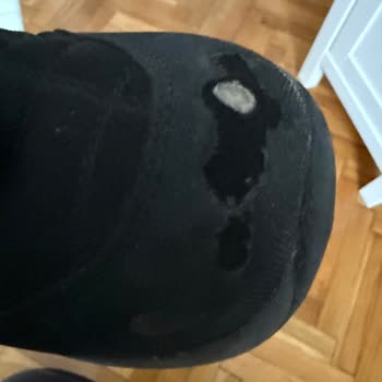 Kısa Sürede Yırtılan Çocuk Ayakkabısının Kalitesizliği Ve Ücret İadesi Talebi