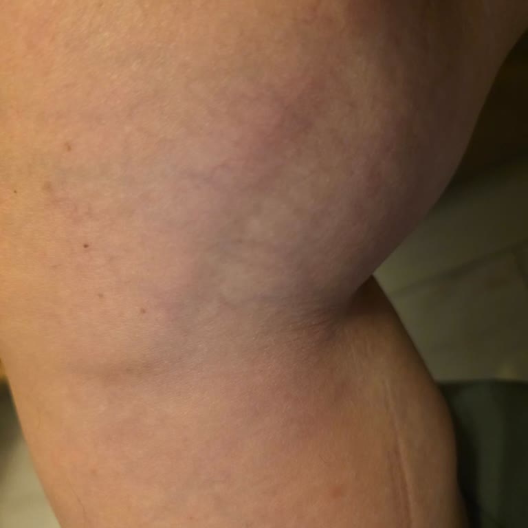 Prof. Dr. Mustafa Bolat Süreç Yanlış Yönetildi Ve Acil Ameliyatlık Tablo İle Karşı Karşıyayım