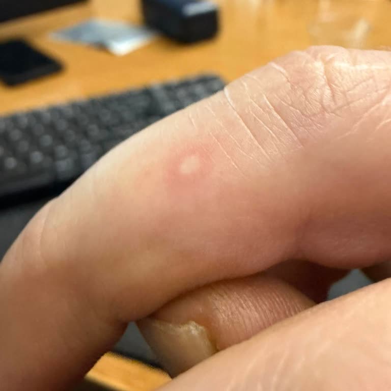 Marlboro Edge Blue Sigara Paketlerinde Kıymık Ve Odun Parçalarının Bulunması