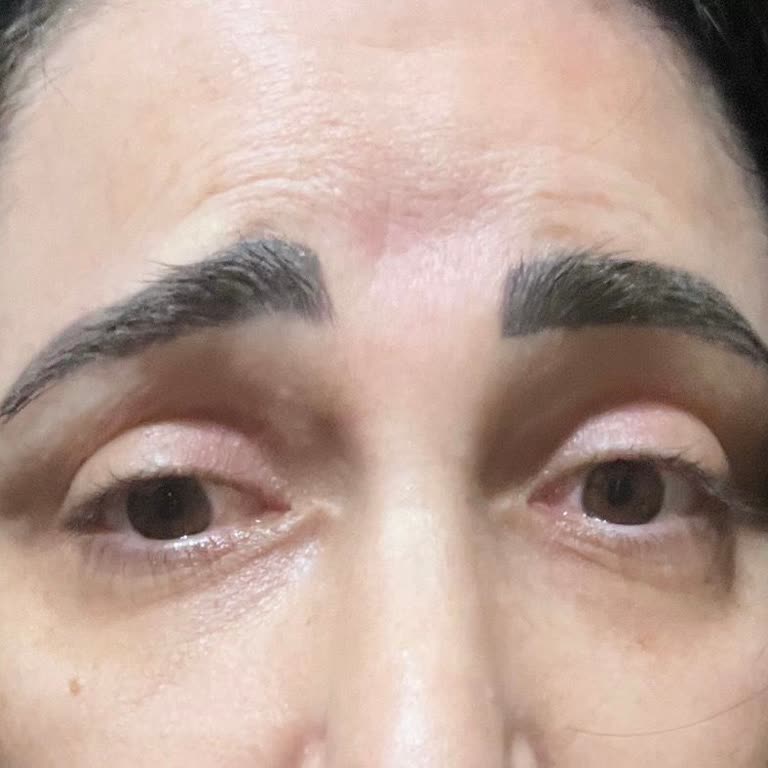 Clinicas World İşlem Yaptırmak Hayatımın Hatası Oldu