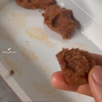 Komagene Çiğ Köfteden Kıl Çıktı