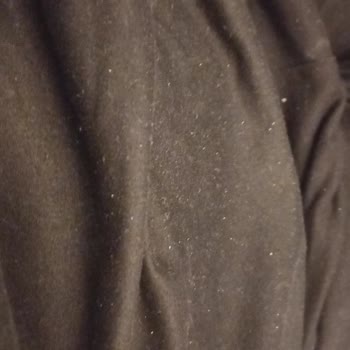 Bioxcin Şampuanı Sonrası Yoğun Kepek, Kaşıntı Ve Saç Dökülmesi