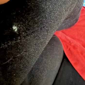 Koltuk Takımının Çökmesi Ve Yırtıkları Nedeniyle İade Talebi