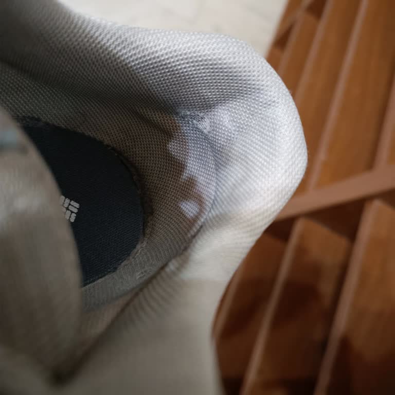 Garanti Reddi: Ayakkabılarda Kullanıcı Hatası İddiası