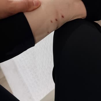 Marjin Botta Kısa Sürede Açılma Ve Yetersiz İade Süreci