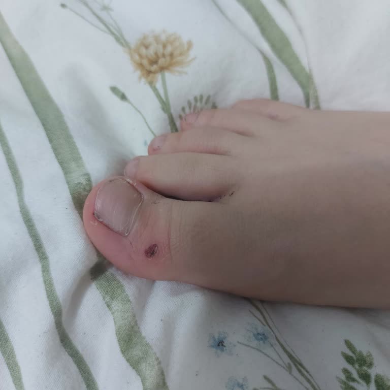 FILA Ayağımı Kanattı: Erzincan Deichmann Mağazasında İade Ve Değişim İsteği