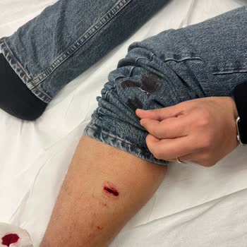 Marmara Forum Paşabahçe Mağazasında İhmal Nedeniyle Bıçak Bacak Kesildi