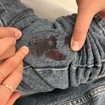 Marmara Forum Paşabahçe Mağazasında İhmal Nedeniyle Bıçak Bacak Kesildi