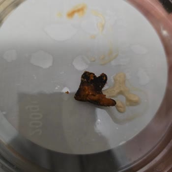 Patos Rolls Cipsinde Yanmış Şüpheli Kütle, Sağlık Riski Ve Cevapsız Şikayet