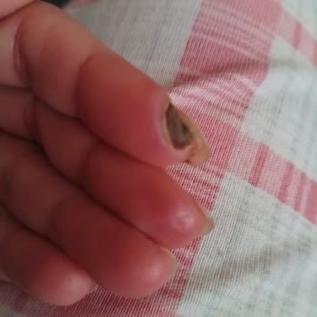 Çalışmadığım Dönemde Çıkarılan GSS Borcu Sağlık Hizmetlerine Erişimimi Engelliyor