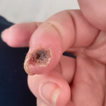 Çalışmadığım Dönemde Çıkarılan GSS Borcu Sağlık Hizmetlerine Erişimimi Engelliyor