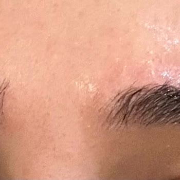 Altın Oran Kaş Alımı Sözü Kırıldı Ve Ağda İşlemi Sonrası Şiddetli Tahriş Yaşadım