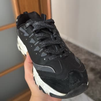 Skechers D'Lites Ayakkabısının Ön Kısmında Patlama, Kalite Sorunu Olarak Kabul Edilmedi