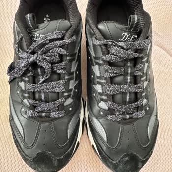 Skechers D'Lites Ayakkabısının Ön Kısmında Patlama, Kalite Sorunu Olarak Kabul Edilmedi