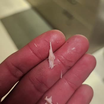 BİM Ton Balığında Kemiğin Damağa Saplanması: Sağlık Ve Güvenlik Endişesi