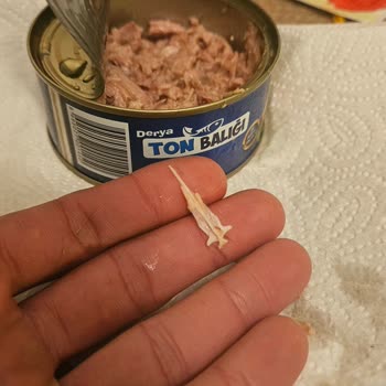 BİM Ton Balığında Kemiğin Damağa Saplanması: Sağlık Ve Güvenlik Endişesi