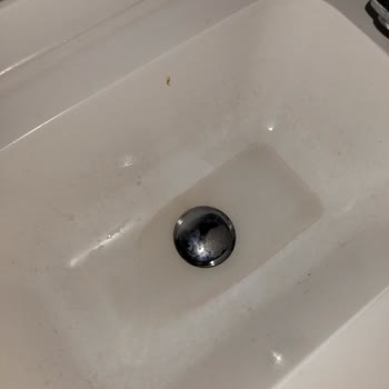 Yatış Katlarındaki Temizlik İhmali Enfeksiyon Riskini Artırıyor