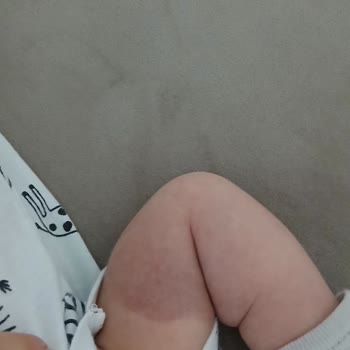 Mimar Sinan Devlet Hastanesi'nde Personel Aldığı Kanı Yere Döktü!