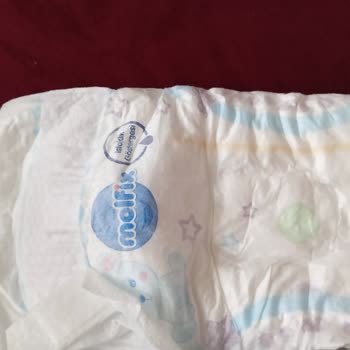 Molfix Bebek Bezinde Sürekli Sızma Ve Emme Gücü Yok: Ücret İadesi Talebi!