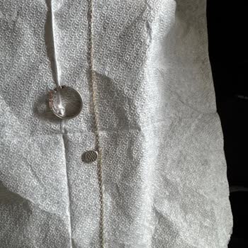 So Chic Renk Değişen Halhal Ve Kararan Yüzük İçin Mağaza Garanti Servisi Reddedildi