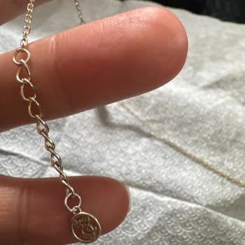 So Chic Renk Değişen Halhal Ve Kararan Yüzük İçin Mağaza Garanti Servisi Reddedildi