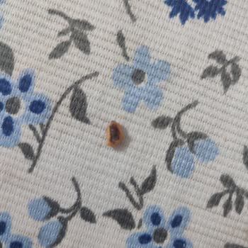 Çikolata İçindeki Büyük Kabuk Parçası Dişimi Kırdı Ve Güvenliğimi Tehlikeye Attı