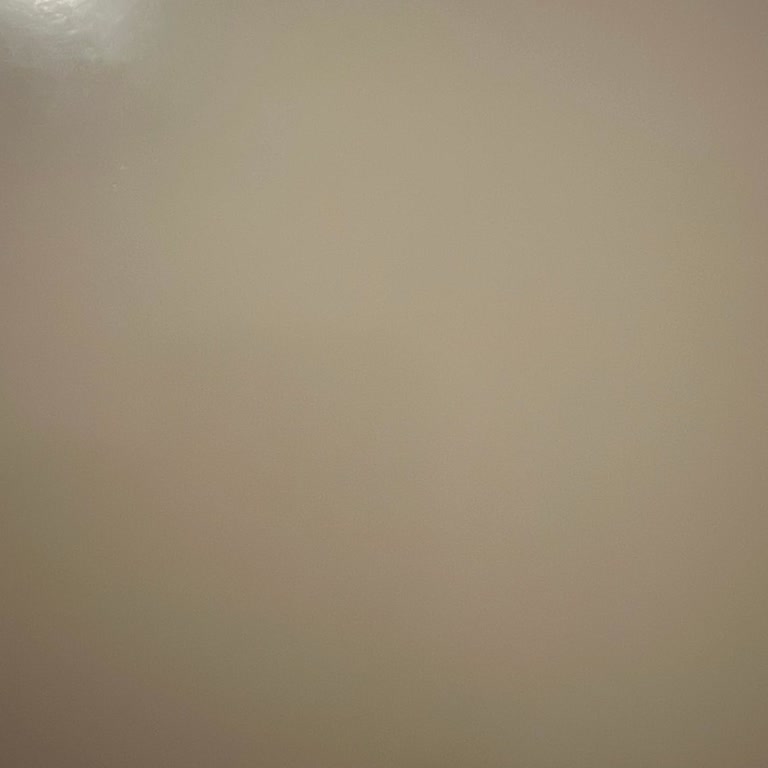 Anadolu Sigorta’da Söz Verilen Ömür Boyu Yenileme Güvencesi Tanımlanmadı