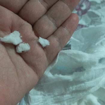 Molfix Bebek Bezinde Sertleşen Emici Katman Çocuğumun Rahatlığını Zorluyor