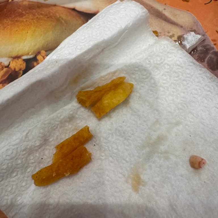 Sert Patates Kızartması Çocuğumun Dişini Kırdı