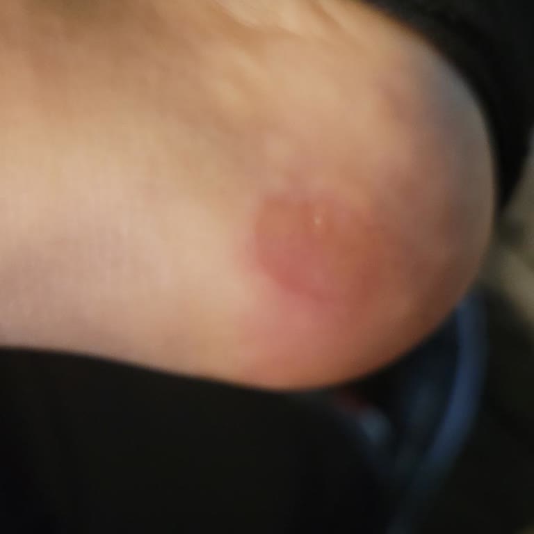 Harley Davidson Botunun İlk Kullanımda Ayağımı Vurması Ve İade Reddi