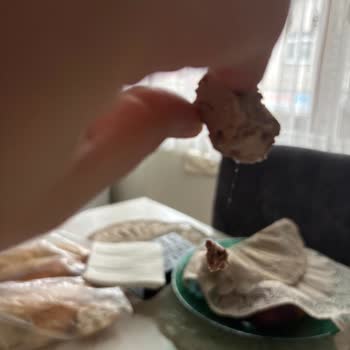 Hun Helvasında Saç Ve Tüy Benzeri Yabancı Maddeler