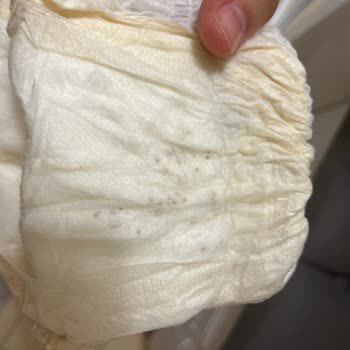 Bezlerde Kahverengi Yabancı Madde Görülmesi, Güven Kaybı Ve İade Talebi