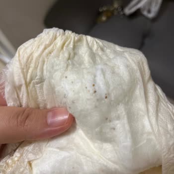 Bezlerde Kahverengi Yabancı Madde Görülmesi, Güven Kaybı Ve İade Talebi