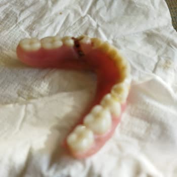 Dent Akademi 82.585 TL’lik İmplant Tedavisinde Sürekli Kırılan Protez Ve İhmal