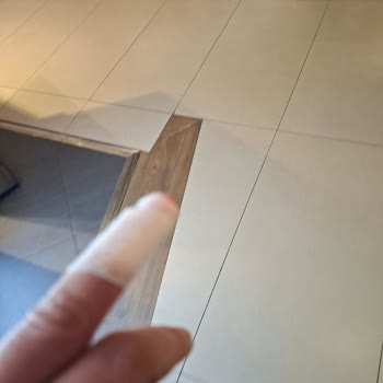 Tedi İş Güvenliği İhlali Nedeniyle Kesilen Parmak Ve Zorunlu Ödeme Talebi