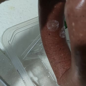 Açılmamış Sucukta Küf: Torku Ürününde Güven Sorunu