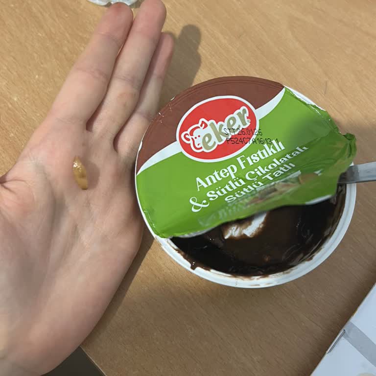 Sağlığımı Tehdit Eden Çikolata İçindeki Çivi Benzeri Yabancı Madde