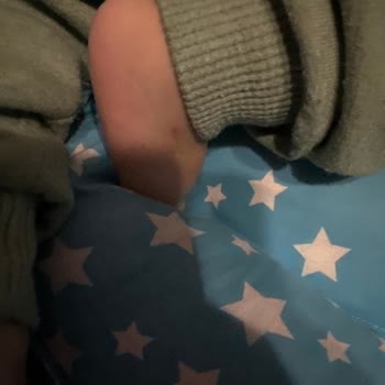 7 Kez Deneme Sonrası Bebeğin Damar Yolu Patlaması, Hastane İhmali