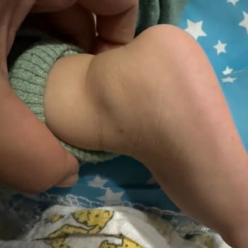 7 Kez Deneme Sonrası Bebeğin Damar Yolu Patlaması, Hastane İhmali