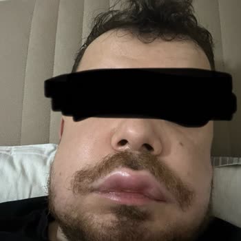 Plaza Ağız Ve Diş Sağlığı Plaza Diş Zeytinburnu’da Yaşanan Hayati Riskli Kanal Tedavisi Hatası