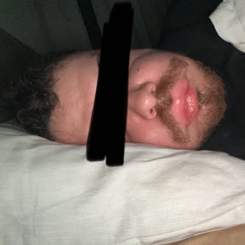 Plaza Ağız Ve Diş Sağlığı Plaza Diş Zeytinburnu’da Yaşanan Hayati Riskli Kanal Tedavisi Hatası